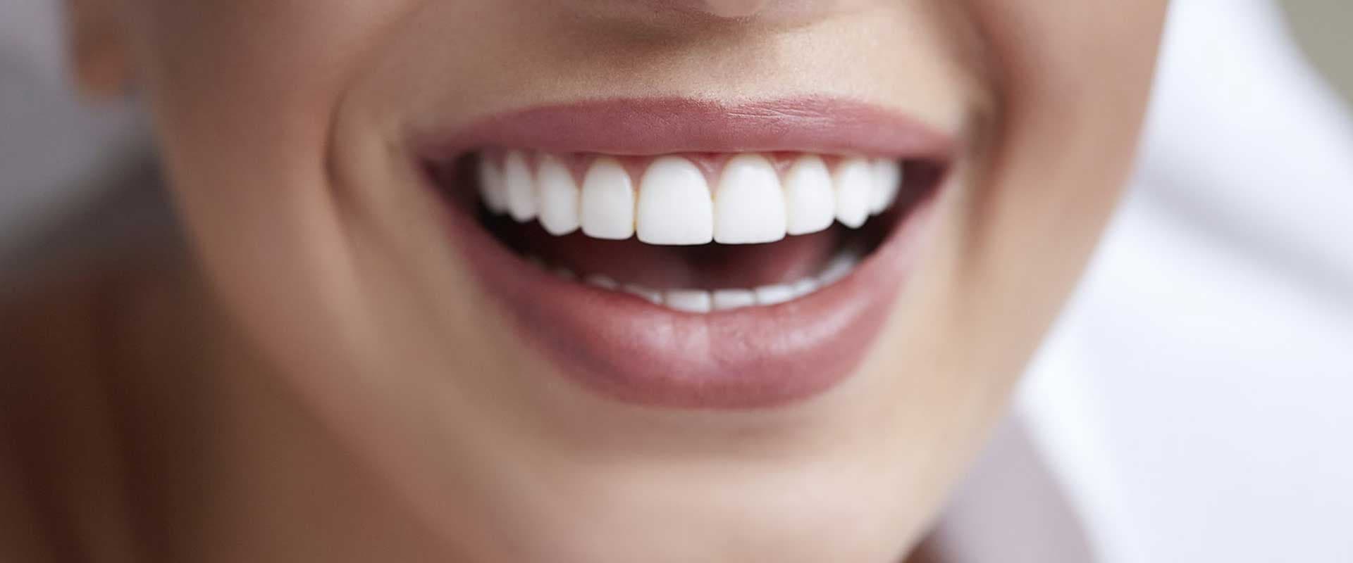 Benefits of Porcelain Crowns