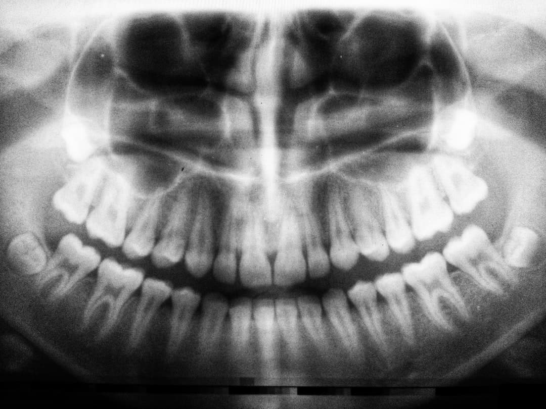 Cracked, Chipped, or Broken: Dealing with Common Dental Emergencies