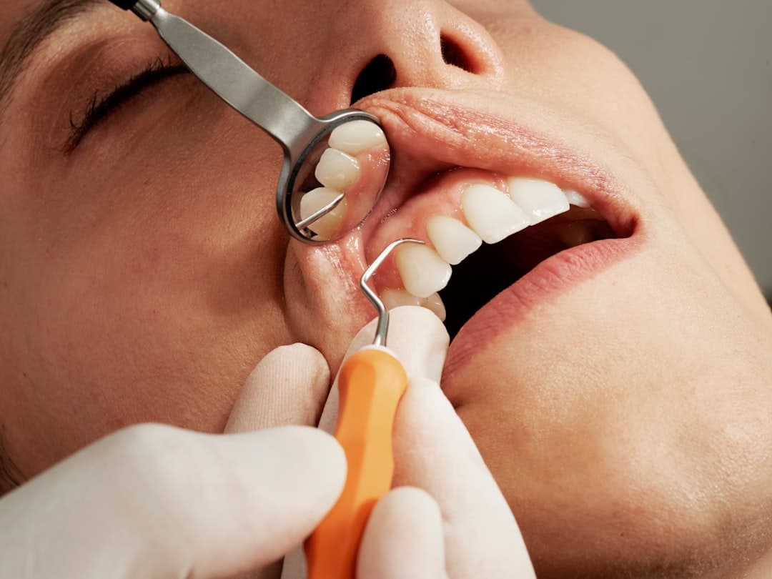 Photo Dental Hygiene 101: Preventing Toothaches Through Proper Care